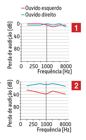 Dois audiogramas da mesma pessoa, com as curvas dos ouvidos direito e esquerdo em função da frequência
